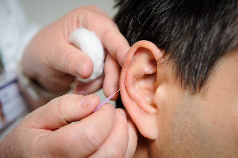A point on the ear, known as the Shen Men, could help you feel better