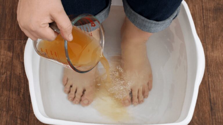 Soaking Swollen Feet In Vinegar? This Is How To Do It To Make It Work